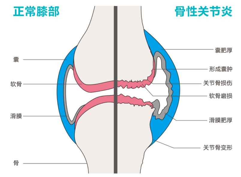 泰猷 复合超声关节炎治疗仪 TY-LS-100产品细节