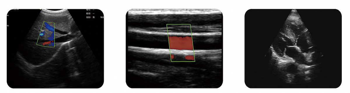 索诺星 SonoStar 全数字超声显像诊断仪 CProbe（三合一）产品优势