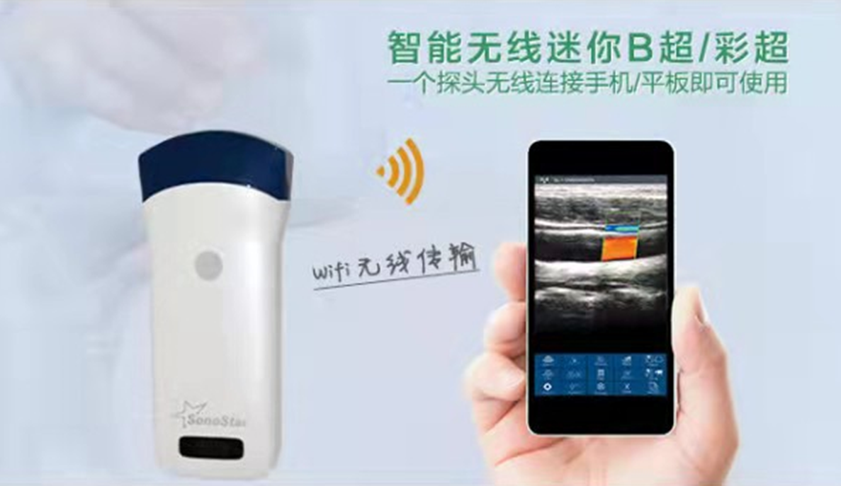 索诺星 SonoStar 全数字超声显像诊断仪 CProbe（凸阵）产品优势