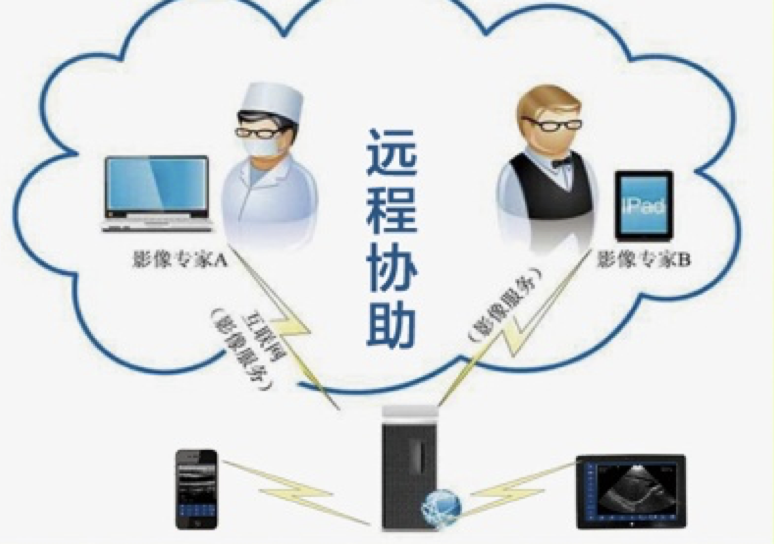 索诺星 SonoStar 全数字超声显像诊断仪 CProbe（腔内）产品优势