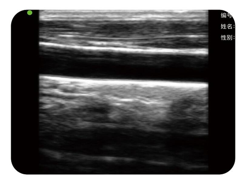 索诺星 SonoStar 掌上彩色多普勒超声显像仪 CScan产品优势