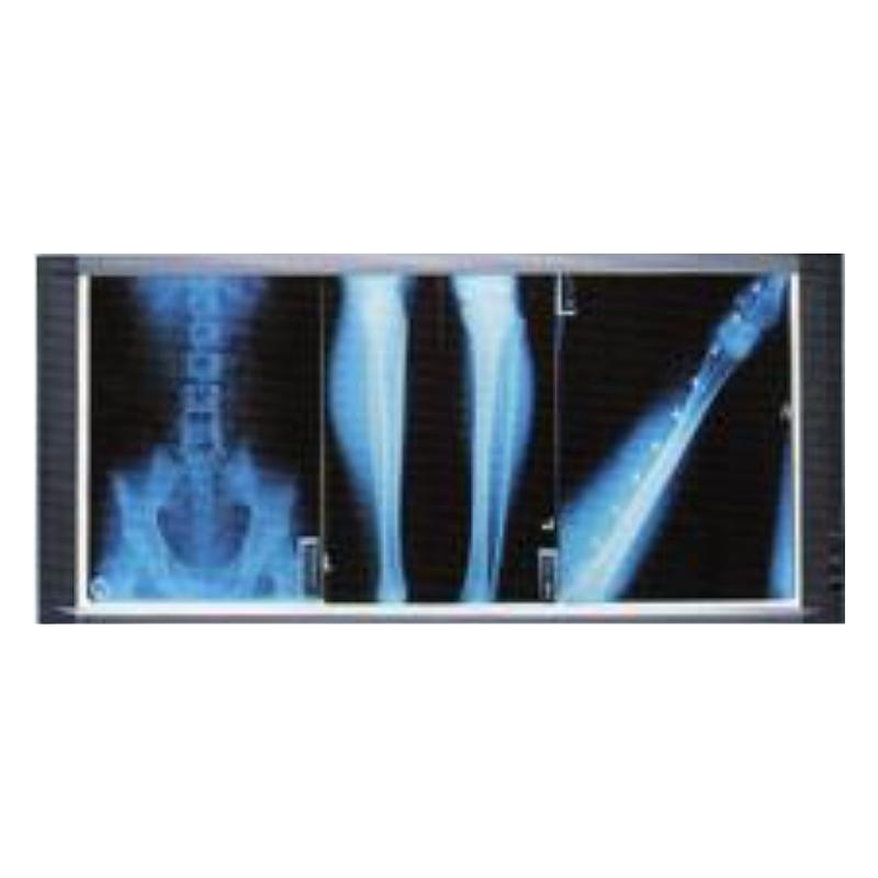 大维同创 X射线胶片观片灯GP-I3（Ⅲ联 8 档可调光）基本信息