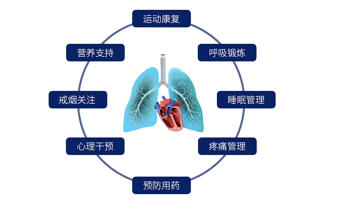 微创康复 MicroPort 心肺康复评估与训练系统 Cortex+ergoline产品优势