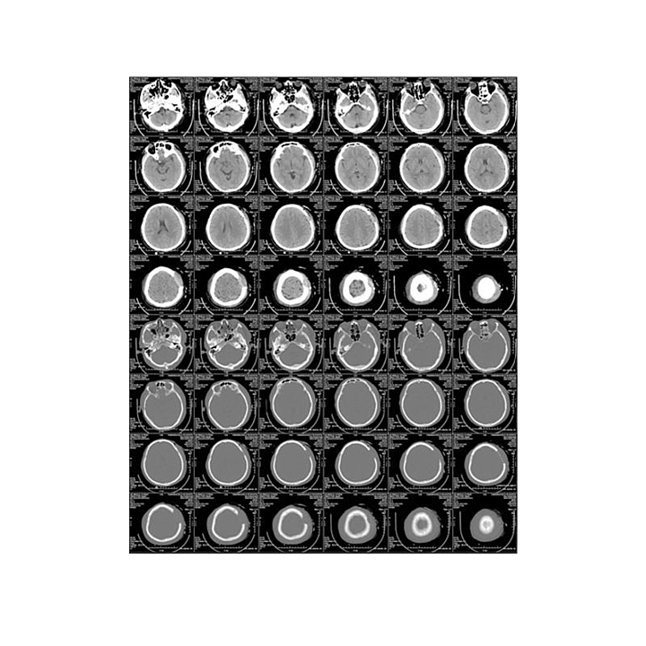 奥西 AUXI 医用干式胶片 14X17基本信息