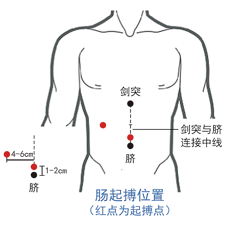 优卓 中频治疗仪（胃肠动力治疗仪） YZ-ZP-D（豪华版）使用方法