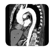 拜耳 BAYER 高压注射系统Contrast Injector MEDRAD Vistron Plus产品优势