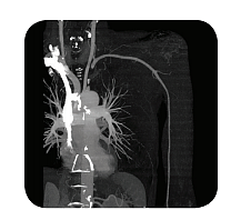 拜耳 BAYER 高压注射系统Contrast Injector MEDRAD Vistron Plus产品优势