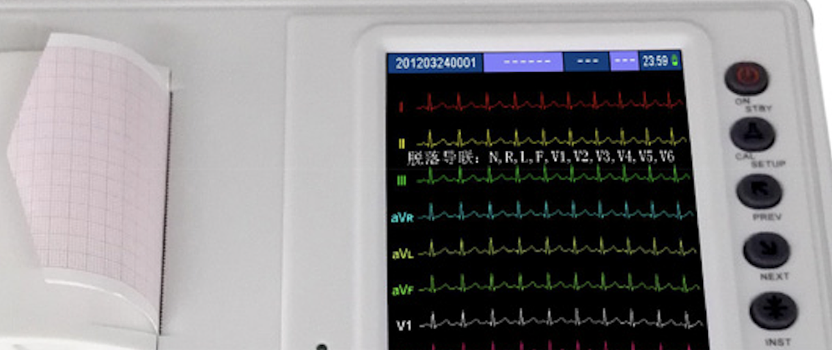安云 itending 数字式心电图机 MK-1203D产品优势