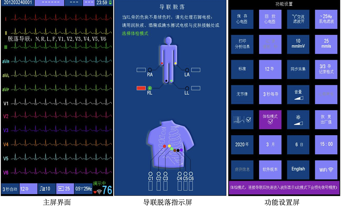 安云 itending 数字式心电图机 MK-1203D产品优势