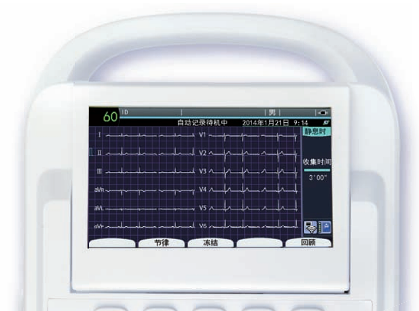 上海光电 多道心电图机 ECG-2350产品优势