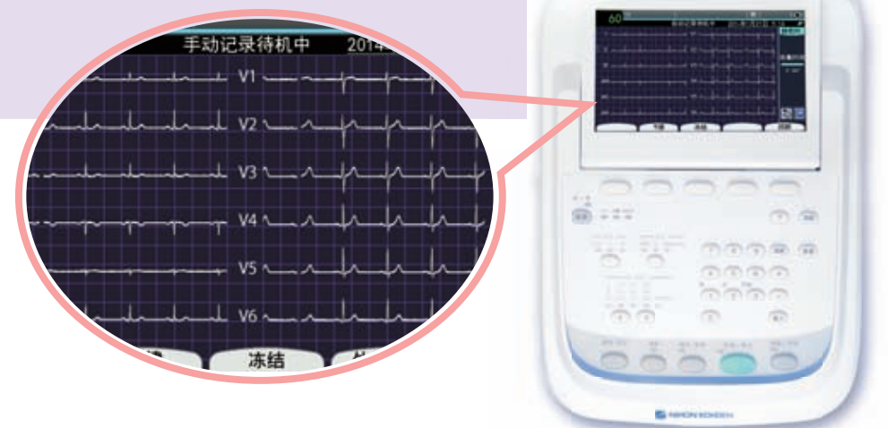 上海光电 多道心电图机 ECG-2350产品细节