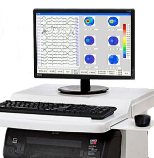 徐州国健 数字脑电地形图仪 EEG-A（普及型）产品优势