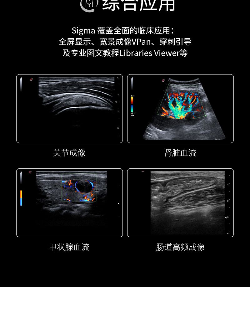 超声诊断系统_05.jpg