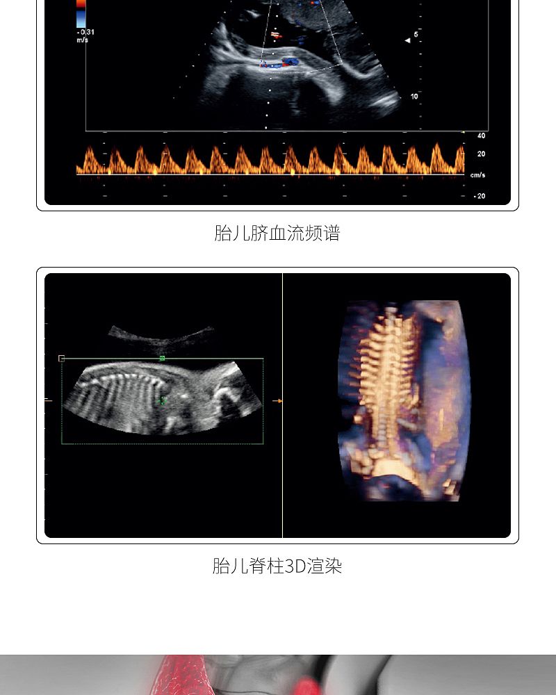 超声诊断系统_09.jpg