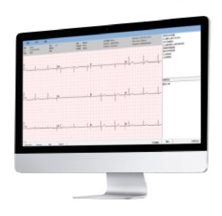 艾瑞康Aricon 十二道心电图机  ECG-12F产品优势