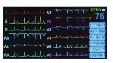 艾瑞康Aricon  三道心电图机 ECG-3D产品优势