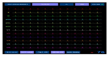 艾瑞康Aricon  三道心电图机 ECG-3D产品优势