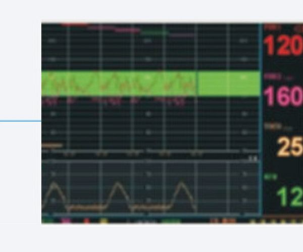 艾瑞康Aricon 胎儿监护仪 FM-6B（三参数）产品优势