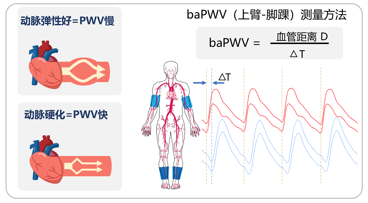 汇医融工HYRG 动脉硬化检测仪 AF-900(便携式)产品优势