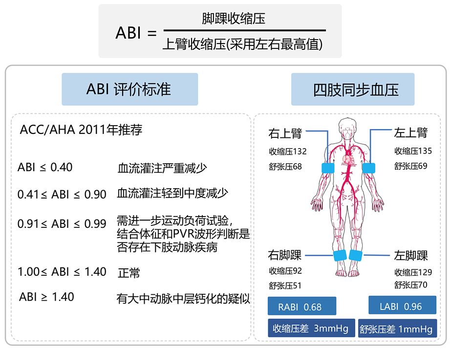 汇医融工HYRG 动脉硬化检测仪 AF-900(便携式)产品优势