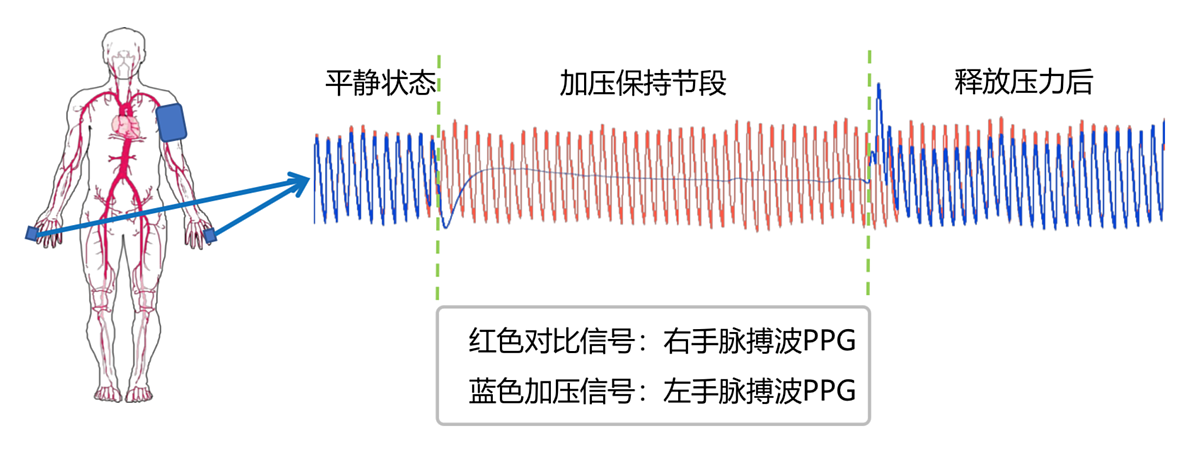 汇医融工HYRG 动脉硬化检测仪 AF-900(便携式)产品优势