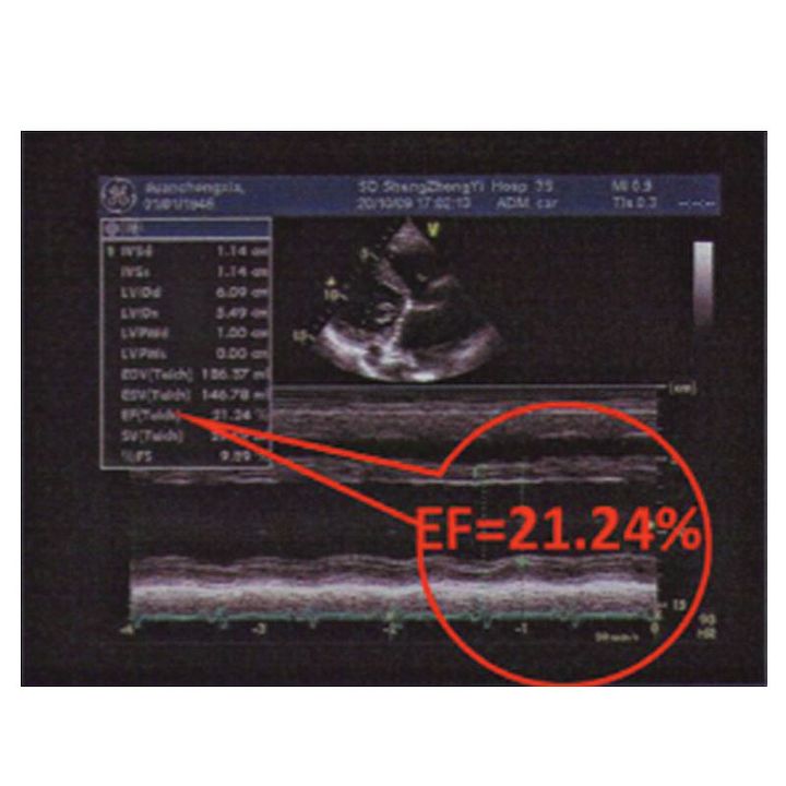 汇医融工HYRG 心血管系统状态监测仪 AF-930产品优势