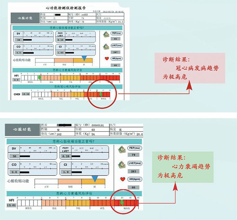 汇医融工HYRG 心血管系统状态监测仪 AF-930产品细节