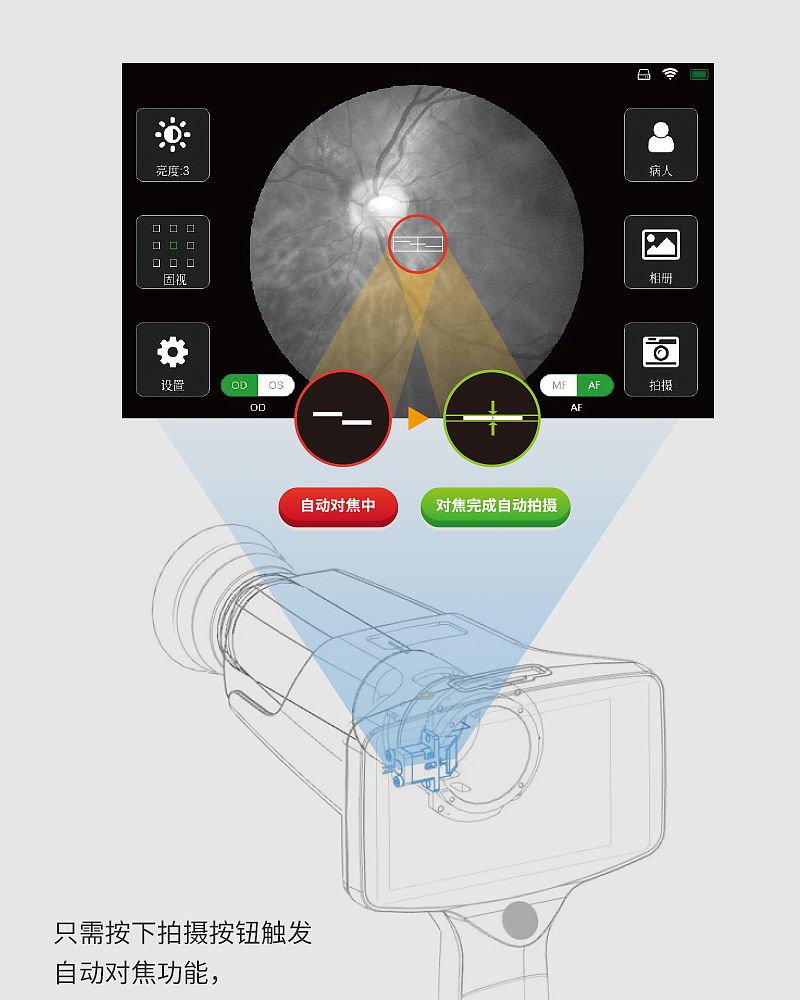 美沃-手持式眼底照相机_03.jpg