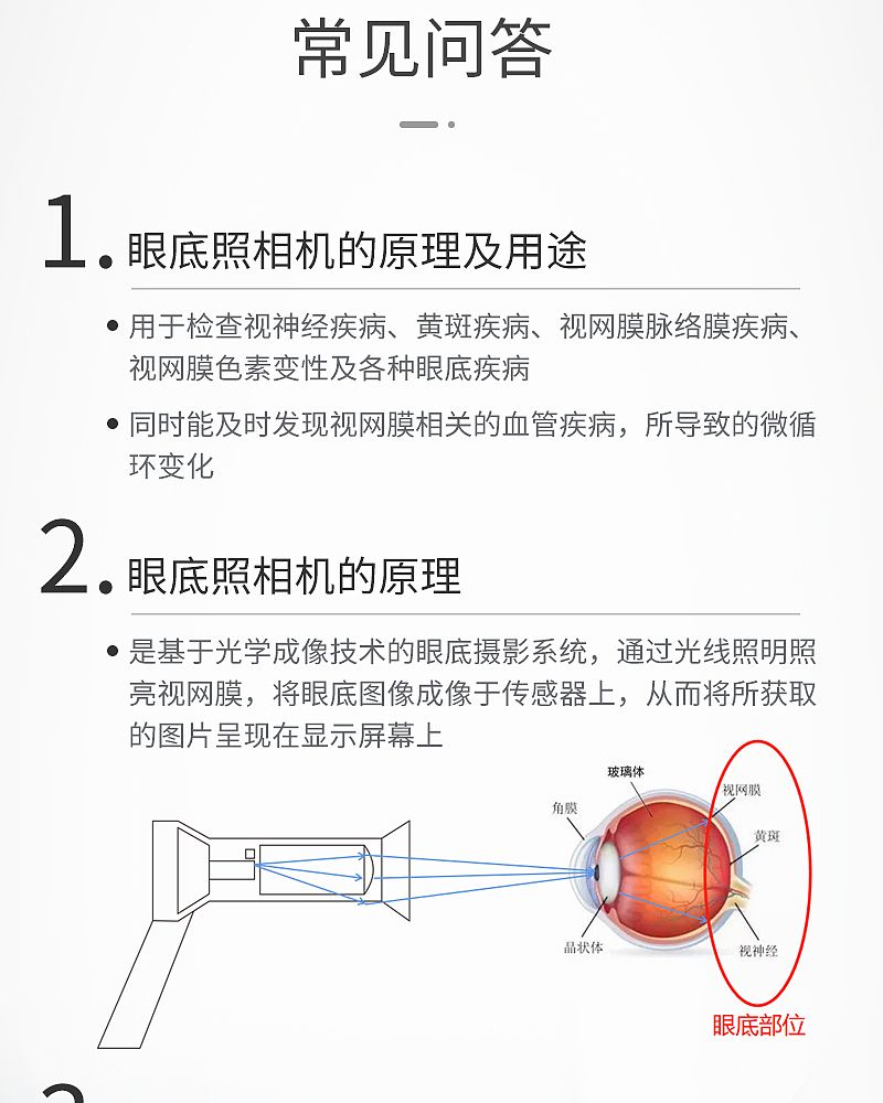 美沃-手持式眼底照相机_10.jpg