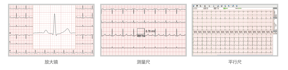 华清心仪 数字化心电工作站 PE-1201产品细节