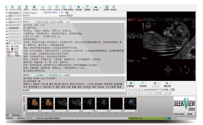 索图  医学影像工作站系统软件 SEEKER-200（带电脑打印机标清版）产品细节