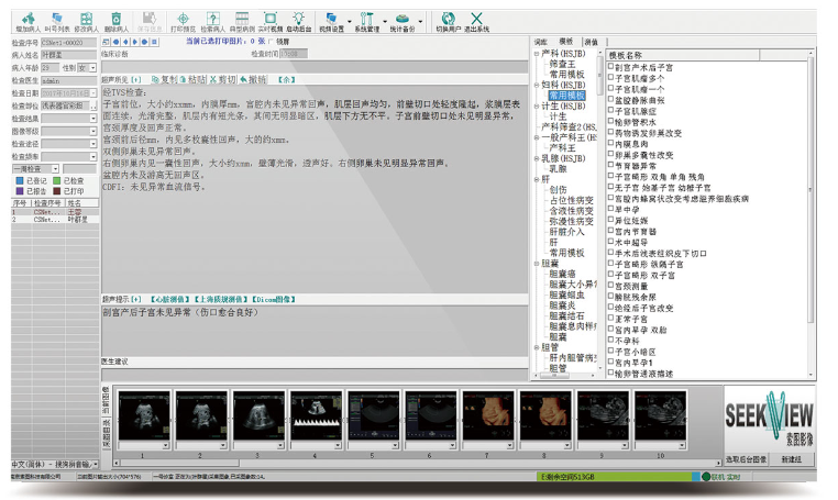 索图  医学影像工作站系统软件 SEEKER-200（带电脑打印机标清版）产品细节