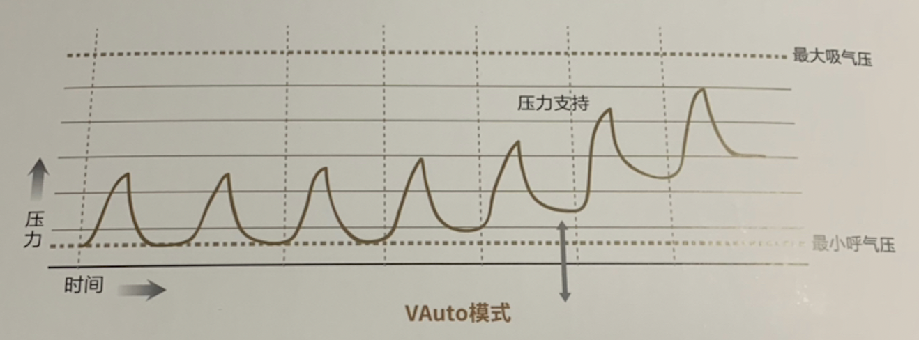 瑞思迈ResMed 双水平正压通气呼吸机 S9 Auto25（国产）产品优势