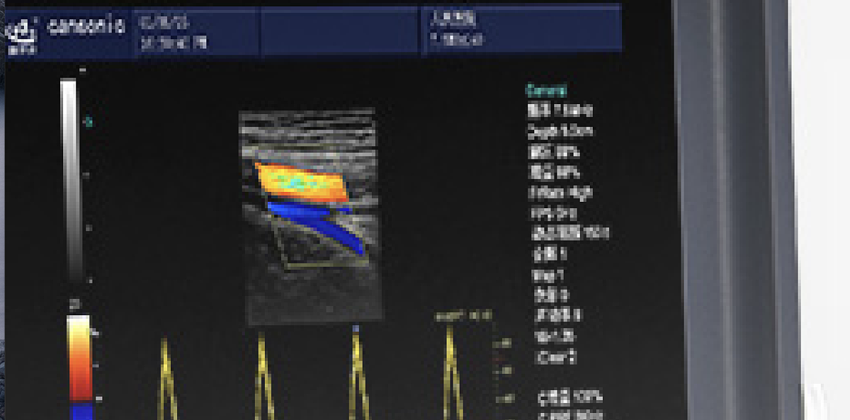 科美达 全数字彩色多普勒超声诊断仪 K6产品优势