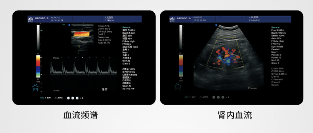 科美达 全数字彩色多普勒超声诊断仪 K6产品优势
