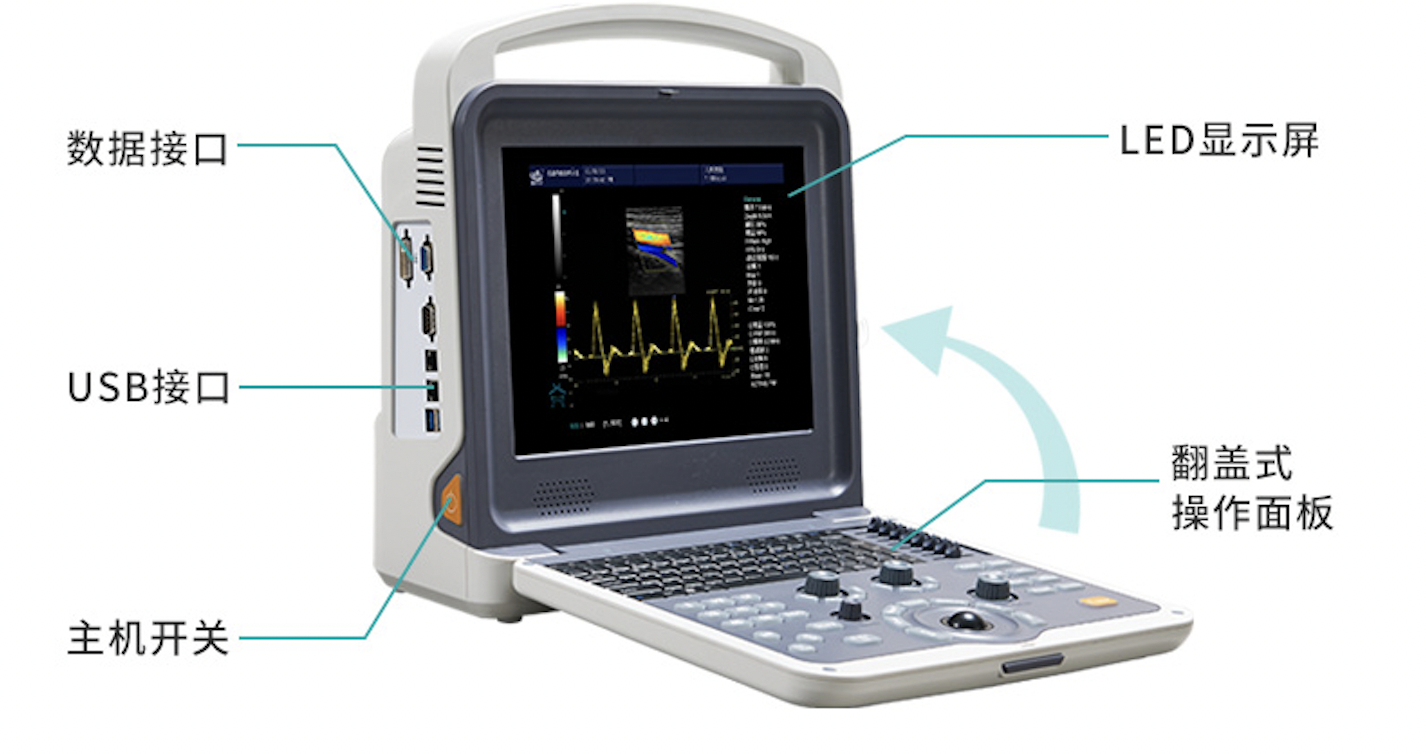 科美达 全数字彩色多普勒超声诊断仪 K6产品细节