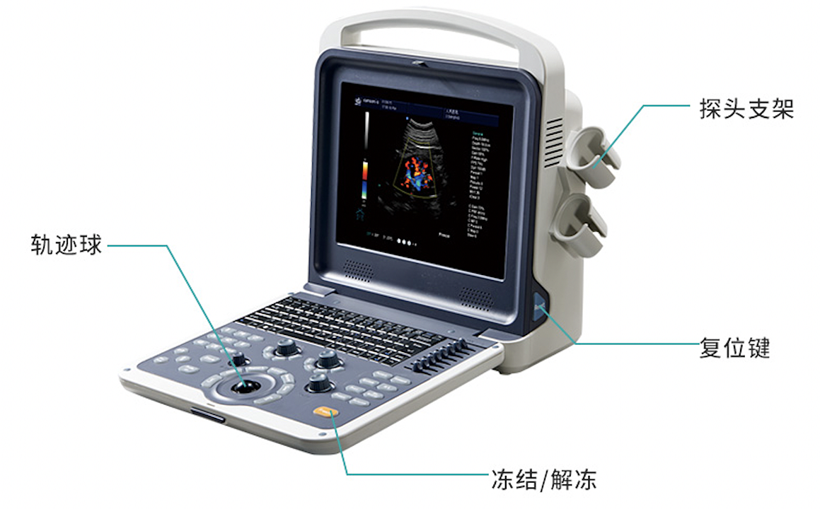 科美达 全数字彩色多普勒超声诊断仪 K6产品细节