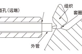 南京微创 一次性使用内窥镜活体取样钳 1800mm（100把/箱）使用方法