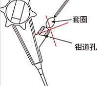 南京微创 一次性使用圈套器 φ36mm×2300mm（10支/盒 10盒/箱）使用方法