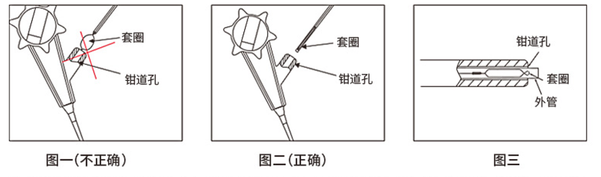 南京微创 一次性使用圈套器  φ24mm×1800mm（10支/盒 10盒/箱）使用方法