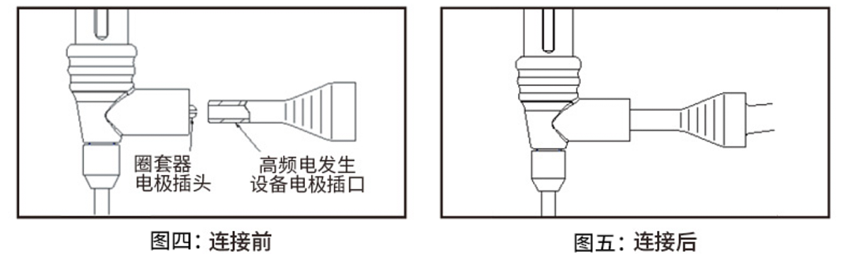 南京微创 一次性使用圈套器  φ24mm×1800mm（10支/盒 10盒/箱）使用方法