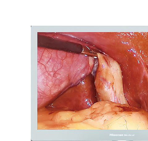 海信 Hisense 医用内窥显示器 HME8C32E产品优势