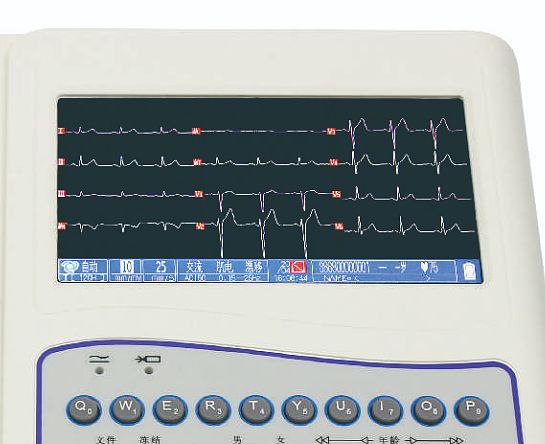 三锐科技 十二道全数字心电图机 ECG-3312产品细节