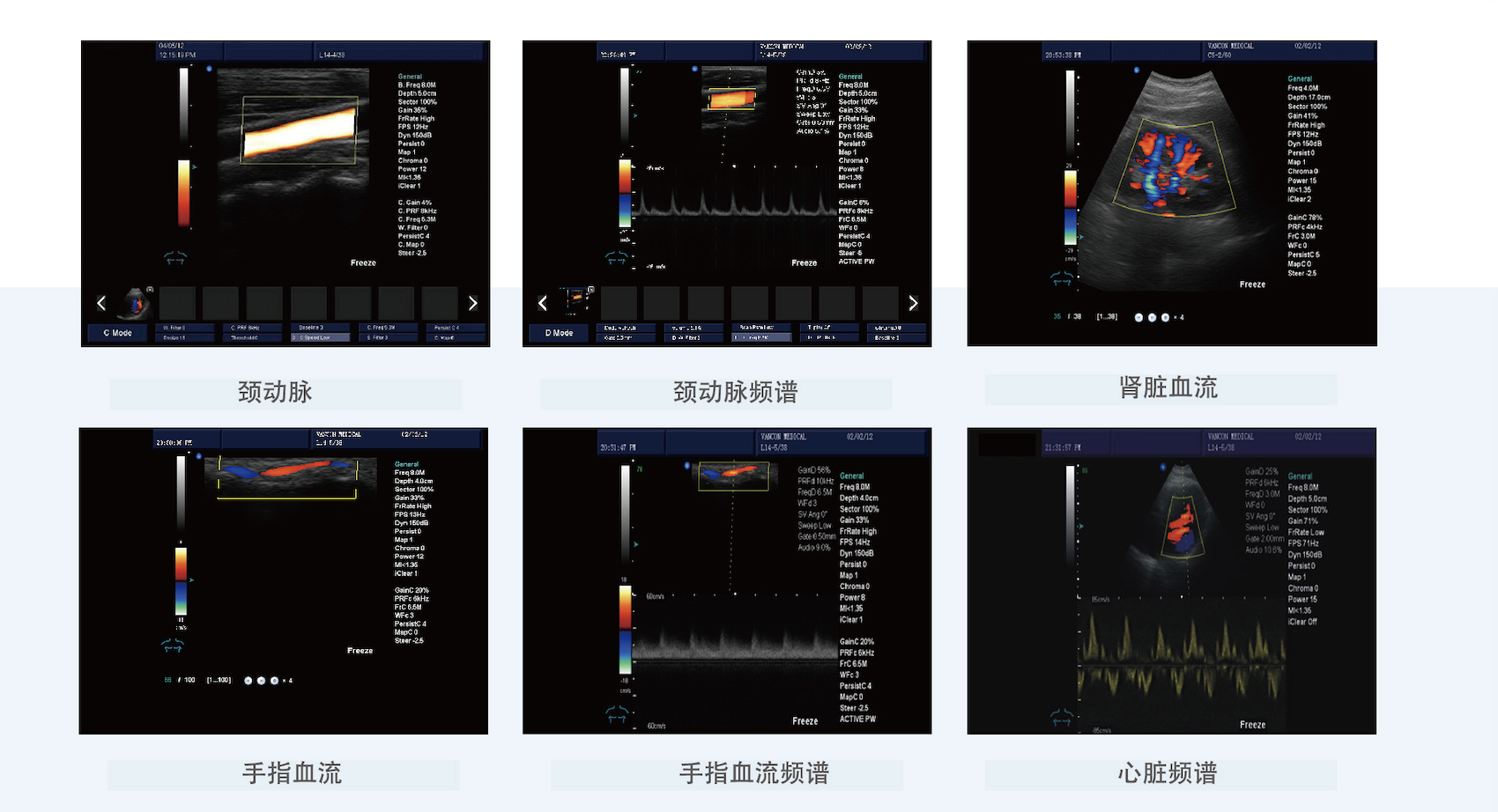 贝尔斯BESE 全数字彩色多普勒超声诊断仪 BLS-X3产品优势