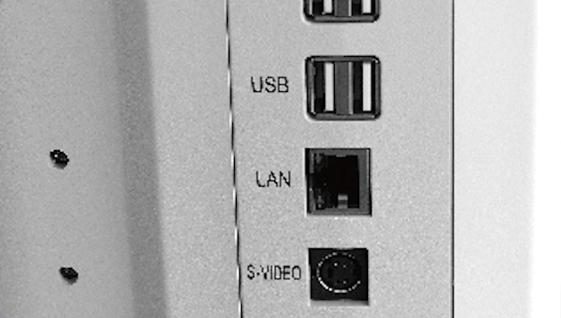 贝尔斯BESE 全数字彩色多普勒超声诊断仪 BLS-X3产品优势