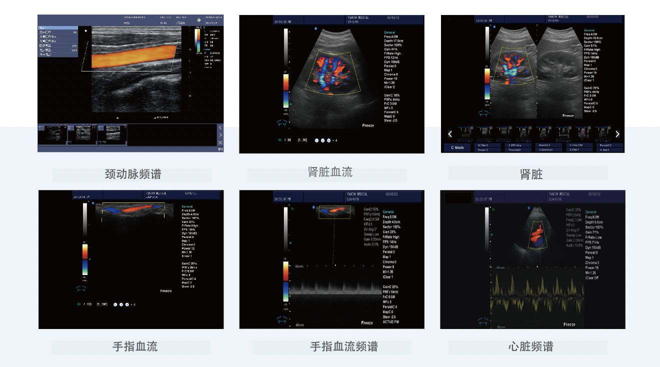 贝尔斯BESE 全数字彩色多普勒超声诊断仪 BLS-X1产品优势
