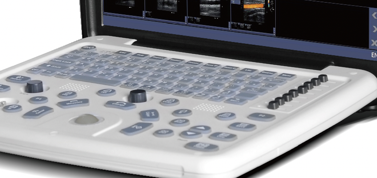 贝尔斯BESE 全数字彩色多普勒超声诊断仪 BLS-X1产品优势