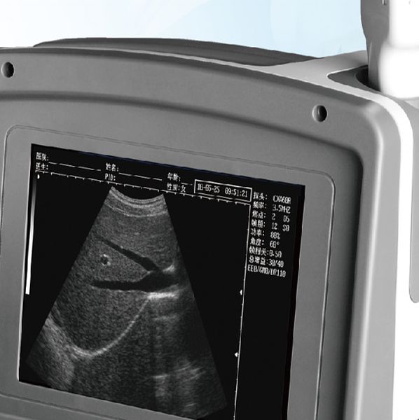 贝尔斯BESE 全数字超声诊断系统 BLS-830产品细节