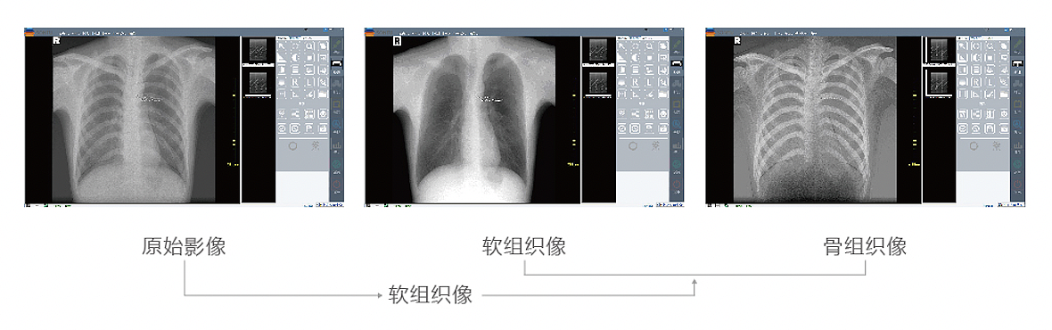 深图SONTU 数字化X射线成像系统 SONTU100-Polaris50产品优势