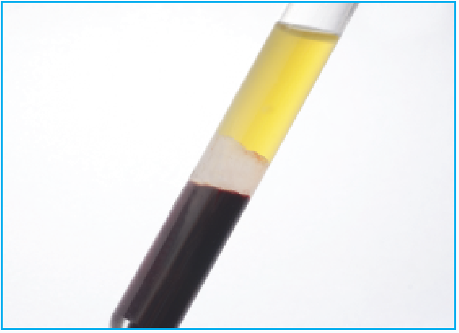拱东 一次性使用真空采血管 无添加剂 红色 PET 2ml（1800支/箱 ）产品优势
